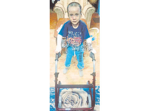 莫哈末哈茲禮目前可站立與移動。