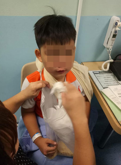  8歲男童臉部受擦傷，也出資按輕微腦震盪。（受訪者提供）