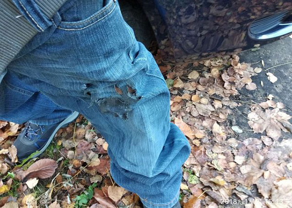 袋里的電子煙爆炸,頓時的氣氛被混亂和鮮血覆蓋。