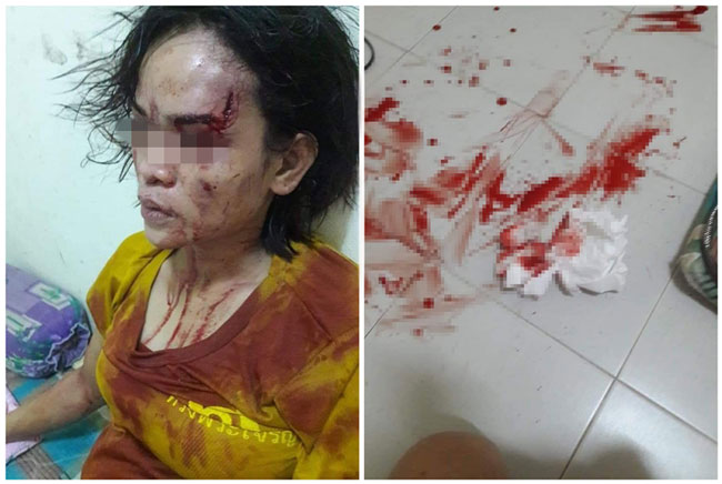 泰國一名婦人剛分娩完不到一個月，就被醉酒丈夫打的頭破血流。