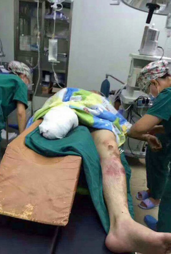 徐前凱傷勢嚴重,需要將右邊膝蓋以下截除才能保命。