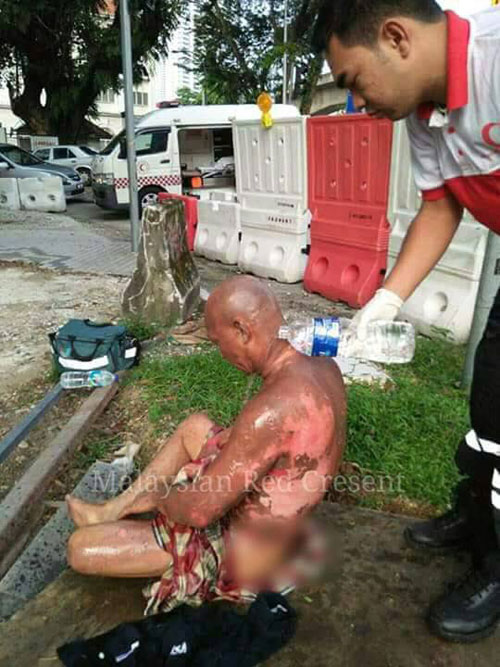 醫務人員趕抵現場后，將傷者送往吉隆坡中央醫院進行治療。（取自互聯網）