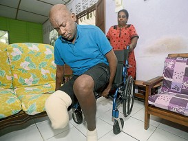 患糖尿病腎病迫截肢 男子籌醫療費裝義肢
