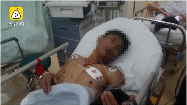 男子遭女友用一把刀猛刺胸口，導致肺部破裂送醫。圖∕梨視頻