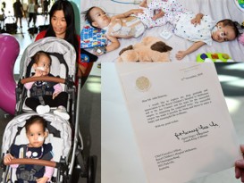 在澳洲成功分体 不丹连体婴出院了！