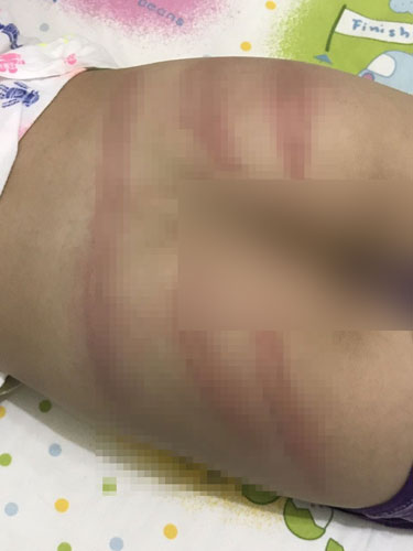 “肉圆辣椒家暴案”受害男童的外公提供去年10月孩子被打屁股的搜证照片。