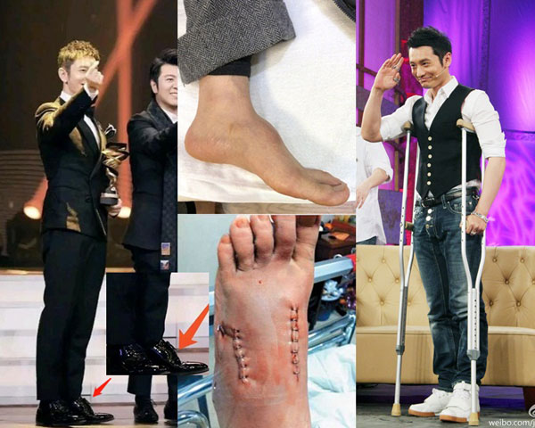 黄晓明日前出席“微博之夜”，被发现左脚不自然隆起，衍生穿增高鞋垫的传言。翻摄微博