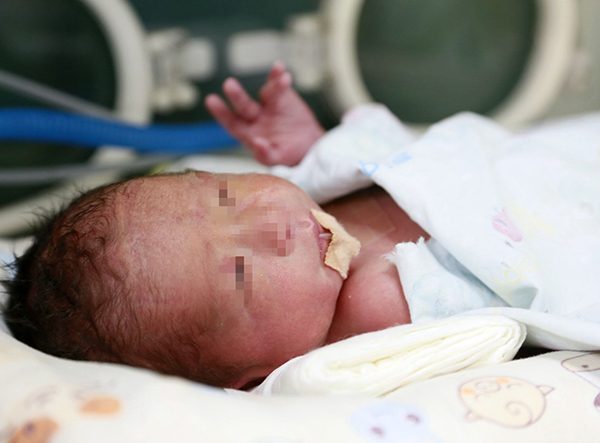 中国首个移植子宫内孕育的婴儿，上周日（20日）出生。（新华社）