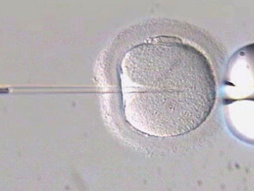 新加坡妇产科医生指出，人工受孕通常只会使用一男一女的精子和卵子。（档案示意图）