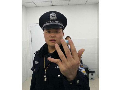 赵姓民警的左手小指头被暴力女折弯。 