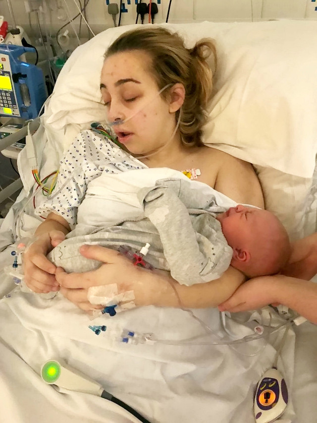 斯蒂芬森入院接受人工昏迷4天后，成了母亲。