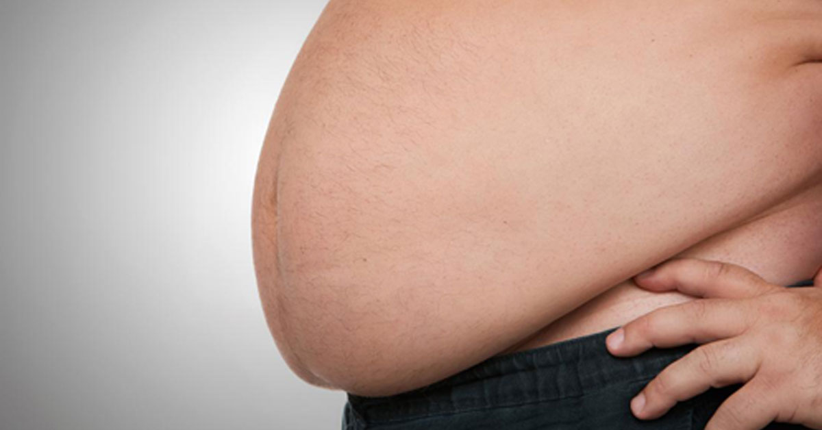 研究者指出，肥胖者较能在中风的情况下存活。图为示意图。