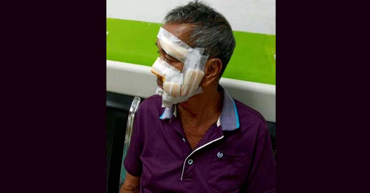 受流浪黑狗攻击脸部重伤男子被送院求医。