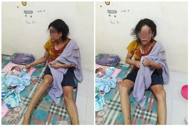 泰国一名妇人刚分娩完不到一个月，就被醉酒丈夫打的头破血流。