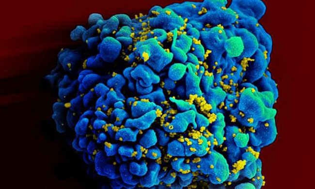 此图显示受到HIV（黄色）感染的H9 T细胞（蓝色）。