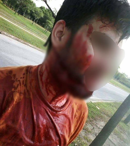 巴基斯坦籍清洁工在街道进行除草工作时，遭2名摩哆匪持刀抢劫，脸部更被划伤毁容。
