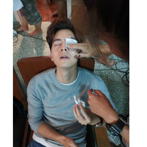 剧组让李伟燊暂停拍摄，并有工作人员帮忙他用热水敷眼睛消肿。