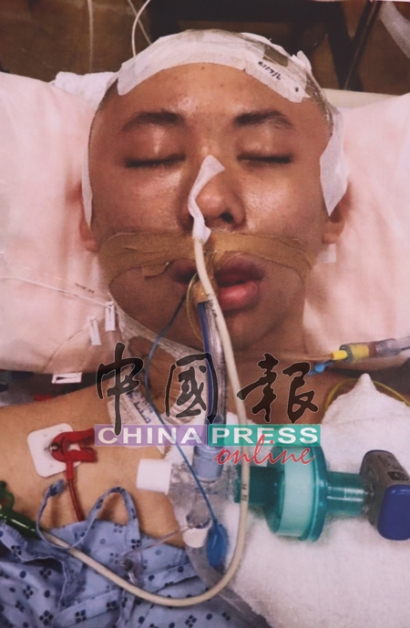 刘宗恒感染鼻窦炎及受细菌感染后，至今已进行3次手术。