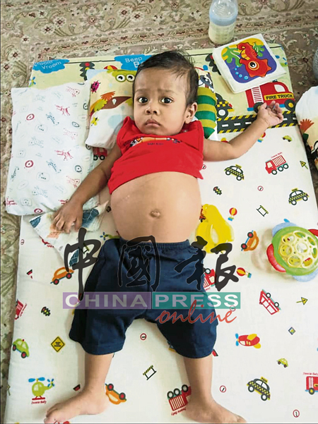 依兹拉夫阿希达自出生就患有先天性胆道闭锁，导致肝功能衰竭，安排在马大医药中心进行肝脏移植手术。