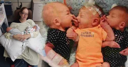 女子误以为肾结石  入院后诞下三胞胎