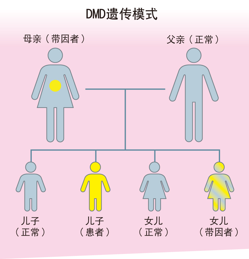 由于DMD是X染色体性联遗传隐性疾病，所以若女性有一个缺陷的X染色体（异常的DMD基因）则通常不会发病，为隐性带因者，但若是男性，只要其自带因者的母亲遗传到有缺陷的X染色体（异常的DMD基因）就会致病。所以，DMD主要影响男性，而女性通常是典型“携带基因者”（简称带因者），可能把受到影响的基因遗传给他们的子女。