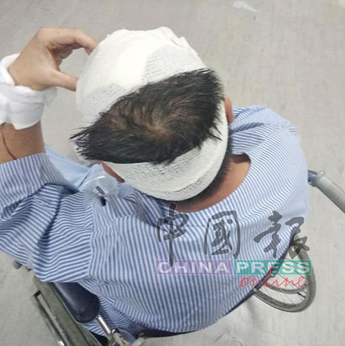 莫姓华裔商人被砍3刀，缝了逾20针，如今在怡保一家私人医院接受观察。