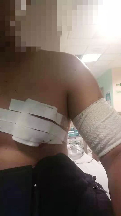 华裔男子被刺伤胸口及手臂，事后被送院治疗。