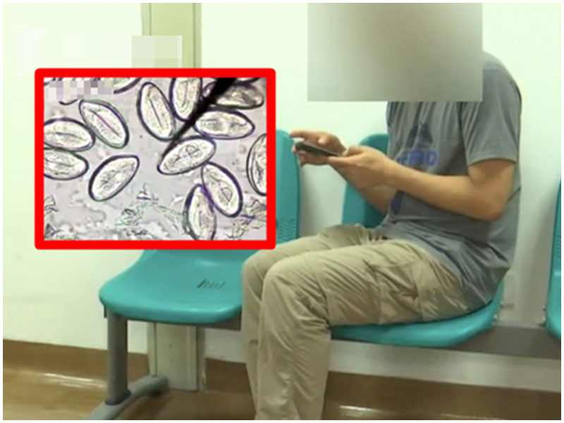 显微镜检验结果显示，男子肝部充满寄生虫。