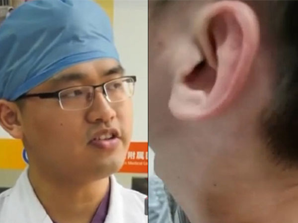 主诊医生马跃（左）扯开患者领口，发现赵先生颈部两侧还有刮痧留下的淡淡红印。