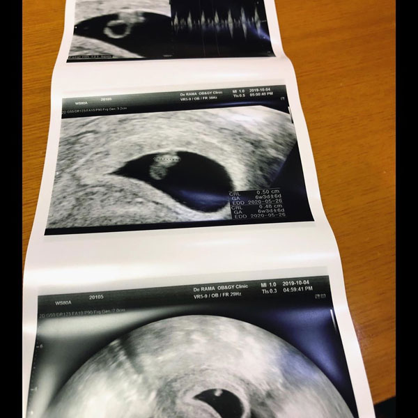 韩雅凛宣布怀孕了。