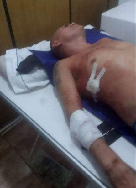 巴里奥斯遭刺伤后送入医院救治的视频截图