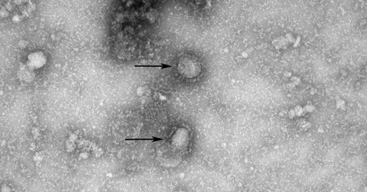 中国官方公开的新型冠状病毒的影像档案照。
