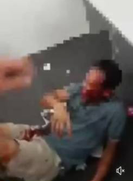 面子书2月1日流传一段视频，受伤中年男子满脸淌血，缩紧双脚卷曲倒地，周围还传出两名叫嚣男子的声音。
