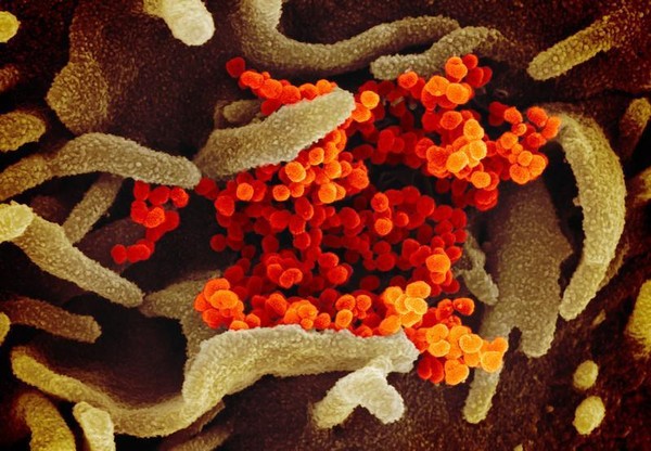 图为显微镜下的新冠肺炎病毒。