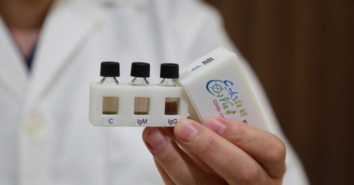 ◤全球大流行◢台中山大学研发快筛瓶 1滴血15分钟有结果 灵敏度升6000倍