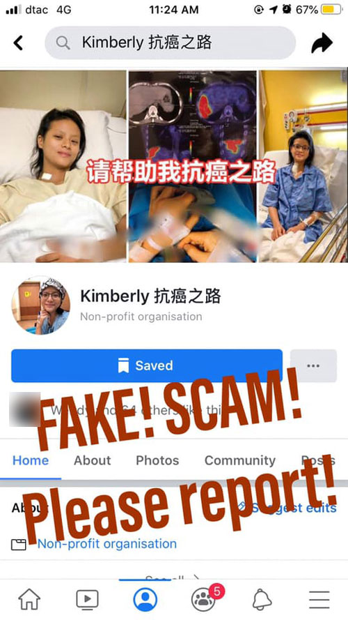 李慧敏的照片也曾被老千盗用并化名为Kimberly在网上募捐。