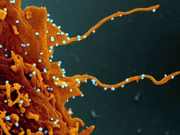 美国加州大学旧金山分校研究团队发现，病毒感染细胞后会透过其丝状伪足去捕捉其他健康细胞。
