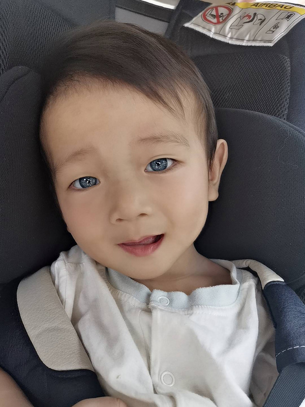 宝宝“洋洋”罹罕见疾病“瓦登伯革氏症”，一双眼睛灰蓝色。