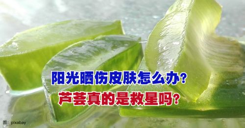 【健康百科】芦荟是晒伤救星？