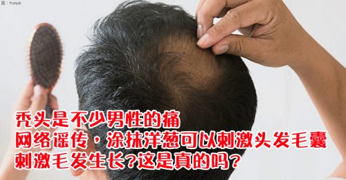 【真消谣】涂洋葱刺激头发毛囊生长?  可能引起皮肤炎