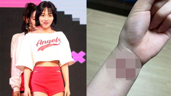 珉娥控诉遭队长智珉欺凌，曾因此想过自杀，并上传手腕伤痕照片。