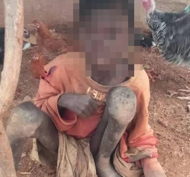尼日利亚一位10岁男童被继母虐待，只能靠动物食物残渣和粪便过活。