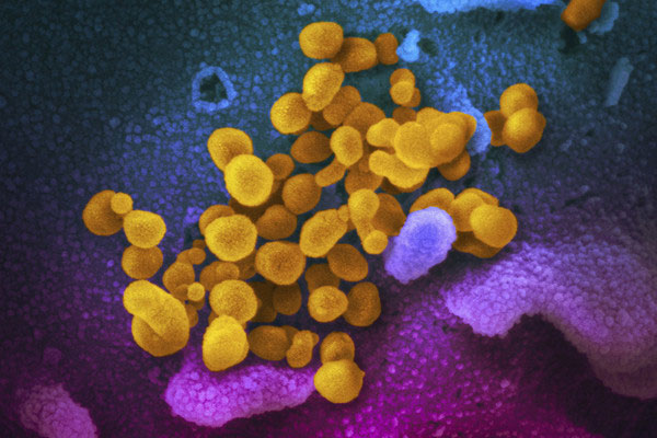美国国家过敏与传染病研究所（NIAID）公布新冠病毒的显微镜照片。
