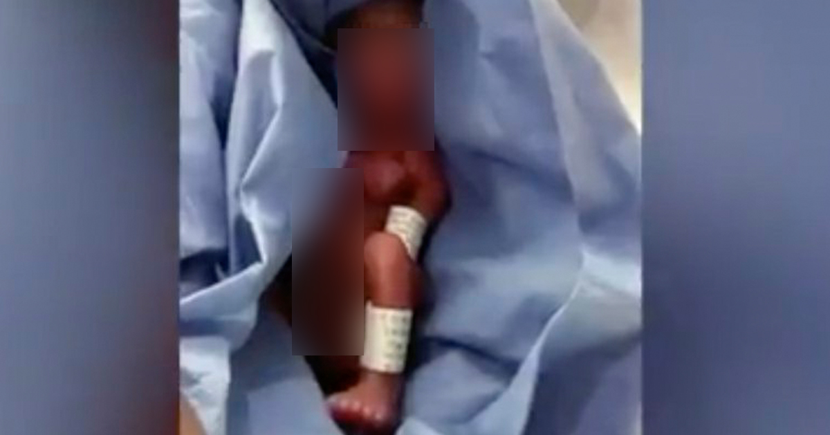 墨西哥医院误判23周早产婴死亡，他躺在冰柜6个小时后“奇迹生还”。