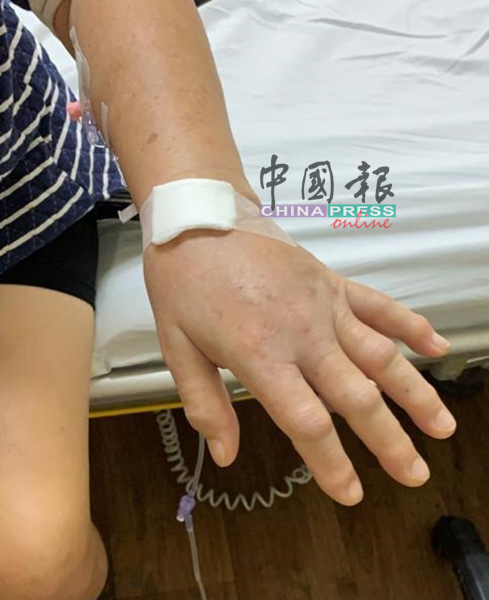 沈荣森的女顾客疑患上基孔肯雅症，双手的关节肿。