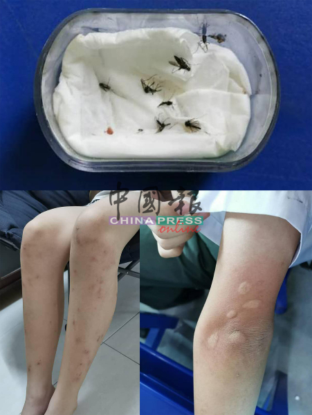 华中学生频频遭“毒蚊”叮咬，而留下的证据。
