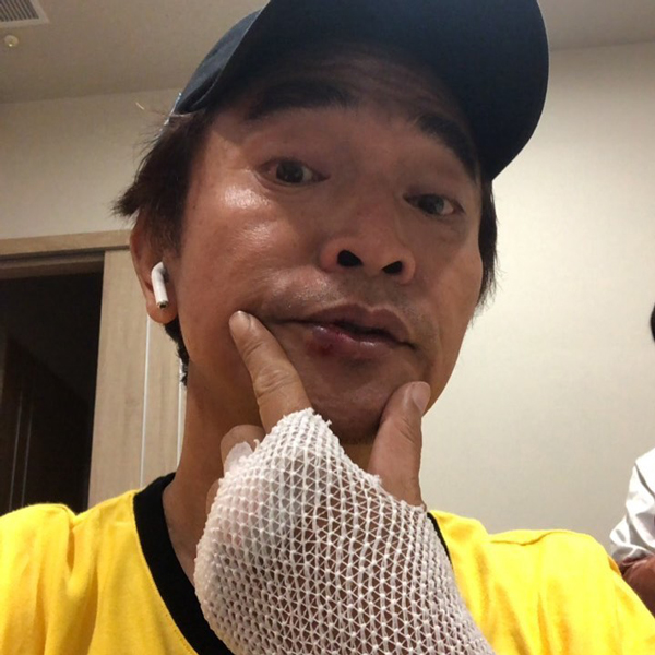 吴宗宪在屏东录制《综艺玩很大》时意外摔车。