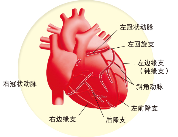 冠状动脉位于心脏表面，是专门为心脏心肌本身供血的血管。它由心脏上方的主动脉窦部发展出两条主干血管，然后像树干一样分出许多分支，包绕着整个心脏。