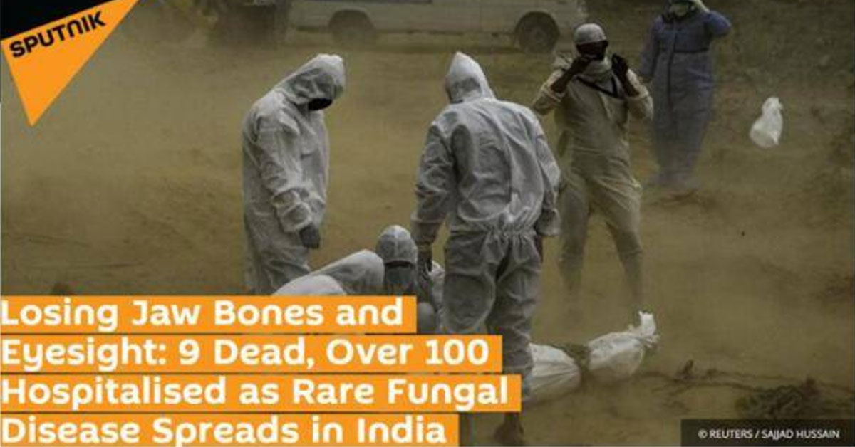 俄卫星社：可能会失去颚骨和视力：罕见的真菌疾病在印度蔓延，已致9人死亡，100多人住院治疗。