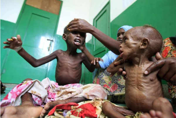 冠病疫情导致全球饥民大增。